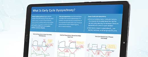 Early Cycle Dyssynchrony infographic